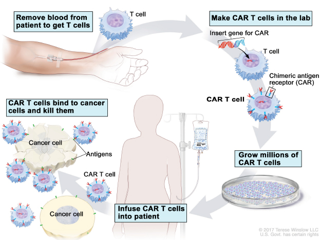 Weighing the Cost and Value of CAR T-Cell Therapy